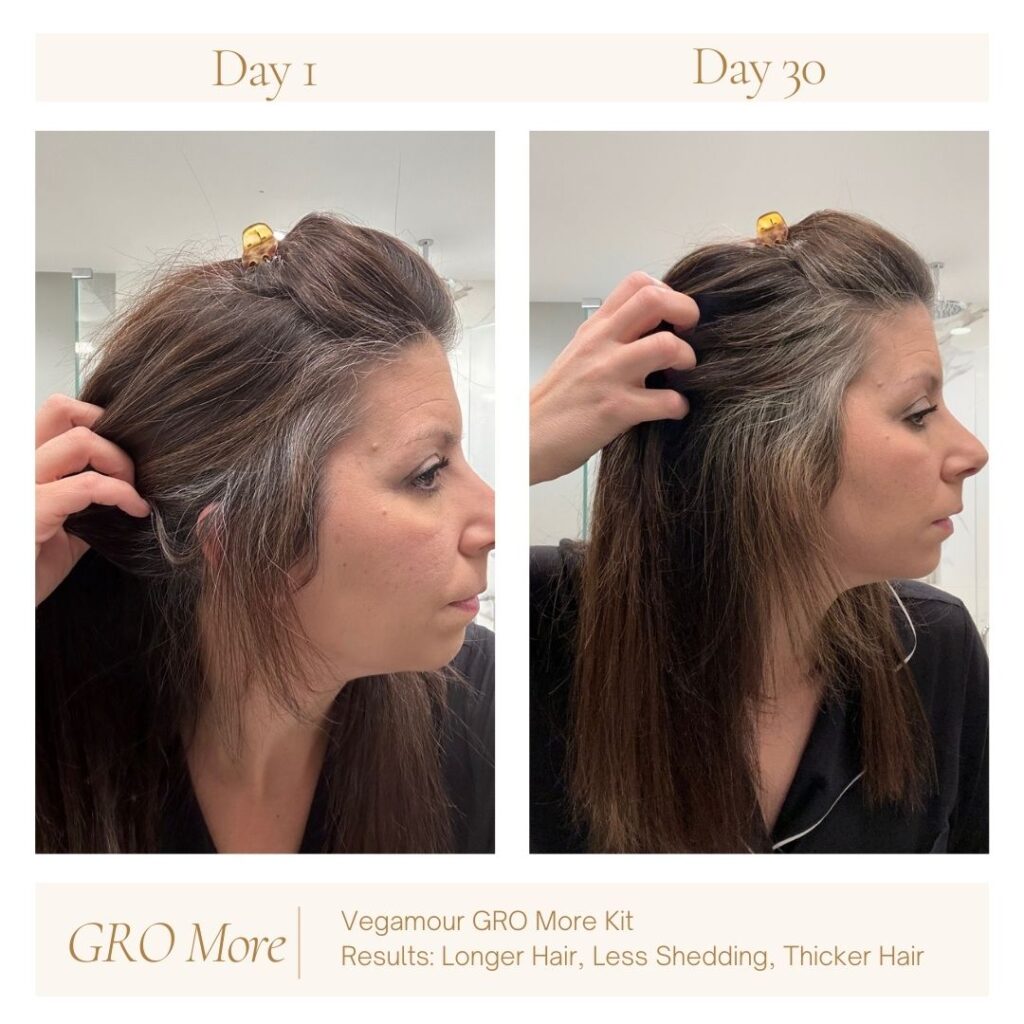 vegamour, GRO More, hair growth supplements