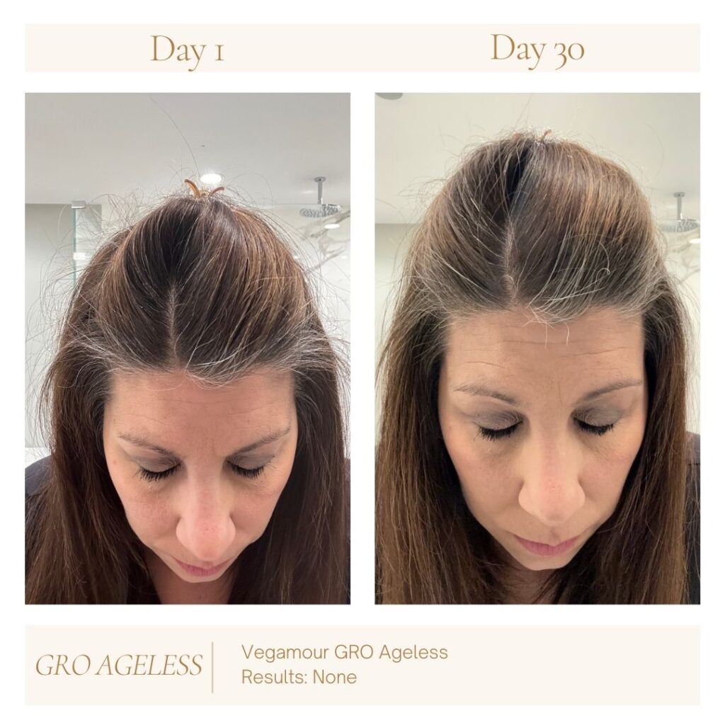 vegamour, hair growth, GRO Ageless